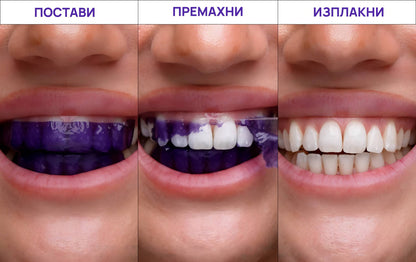 V34 избелващи ленти за зъби